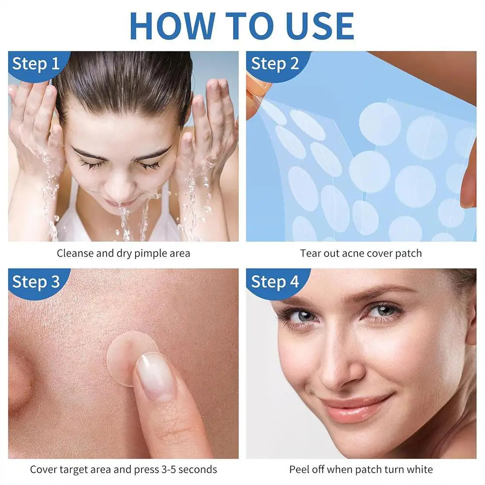 Adesivos Antiacne